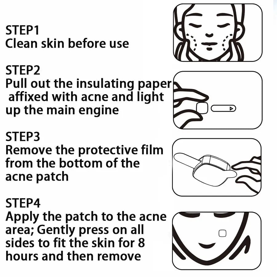 Electronic Acne Patches